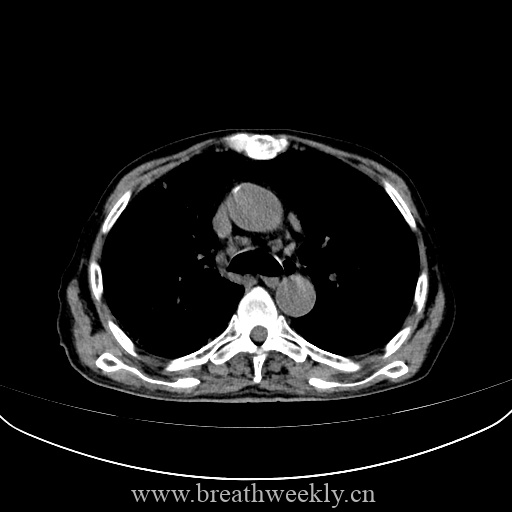 图片[10]-病例库10 | 每周呼吸-每周呼吸
