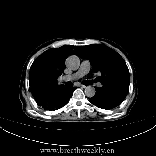 图片[11]-病例库10 | 每周呼吸-每周呼吸