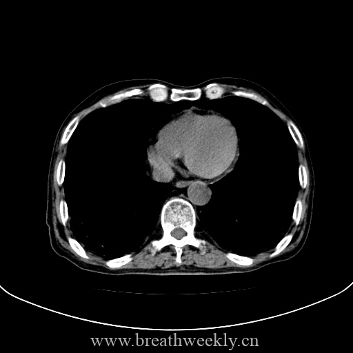 图片[13]-病例库10 | 每周呼吸-每周呼吸
