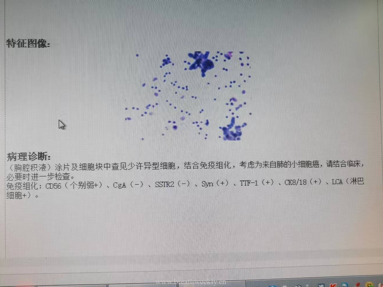 图片[1]-病例60结果 | 每周呼吸-每周呼吸