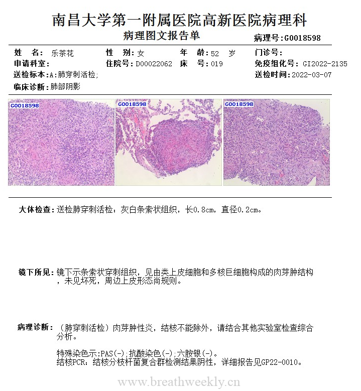 病例53结果-每周呼吸