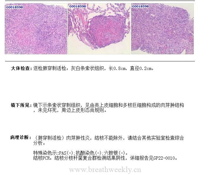 图片[1]-病例53结果 | 每周呼吸-每周呼吸