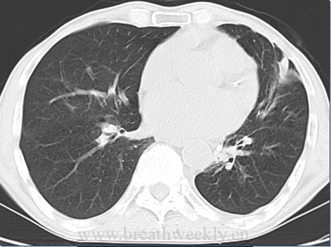 病例51-每周呼吸