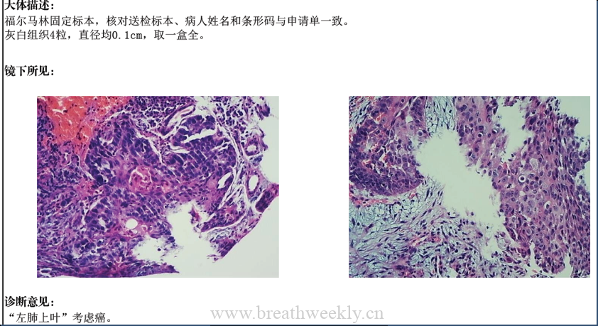 图片[1]-病例51 结果 | 每周呼吸-每周呼吸