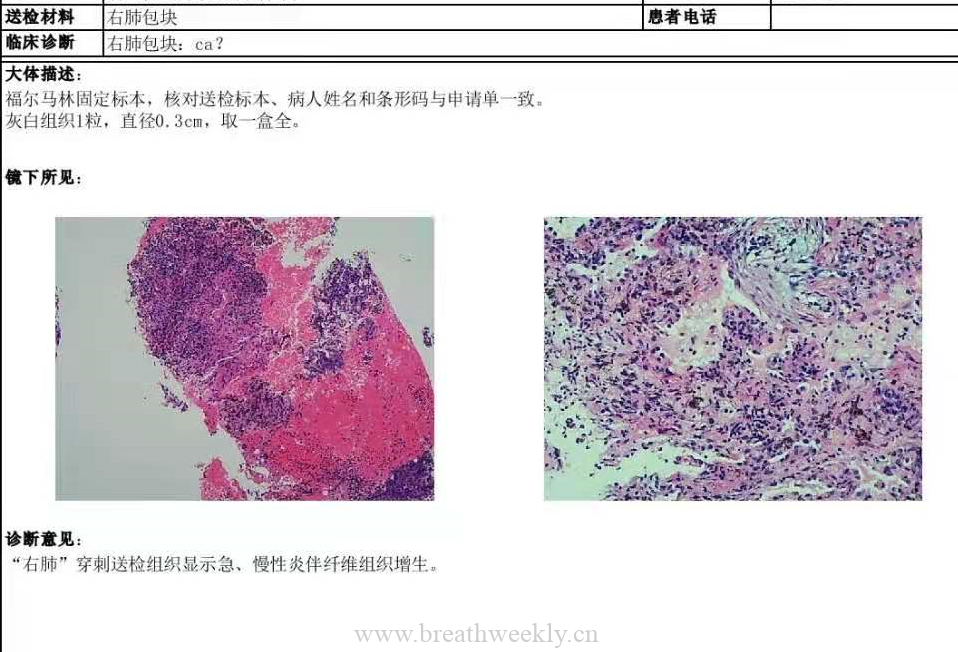 病例50 结果 | 每周呼吸-每周呼吸