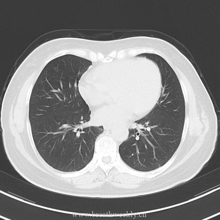 图片[12]-病例43 | 每周呼吸-每周呼吸
