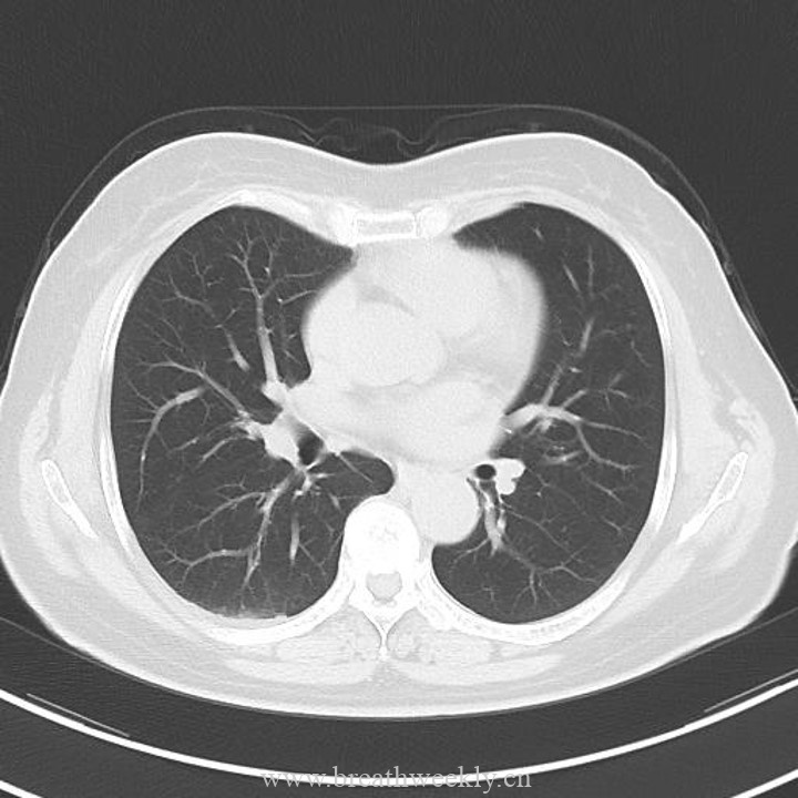 图片[7]-病例43 | 每周呼吸-每周呼吸