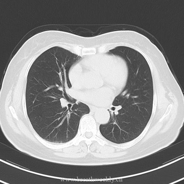 图片[8]-病例43 | 每周呼吸-每周呼吸