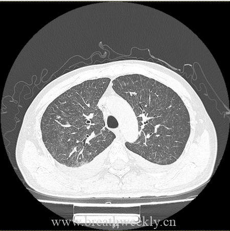 图片[11]-病例66 | 每周呼吸-每周呼吸