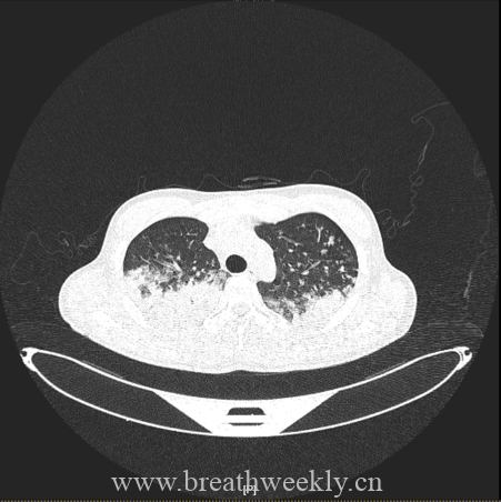 图片[5]-病例67 | 每周呼吸-每周呼吸