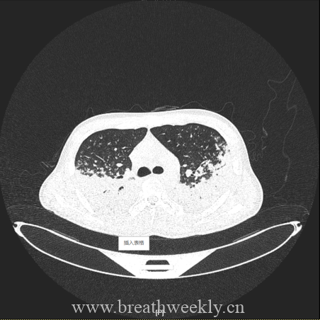 图片[10]-病例67 | 每周呼吸-每周呼吸