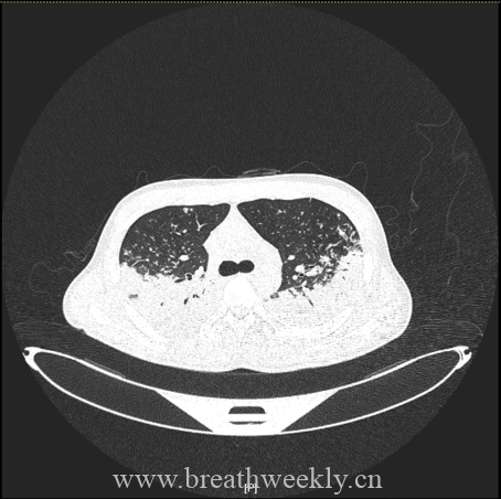 图片[9]-病例67 | 每周呼吸-每周呼吸