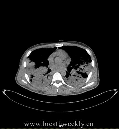 图片[39]-病例67 | 每周呼吸-每周呼吸