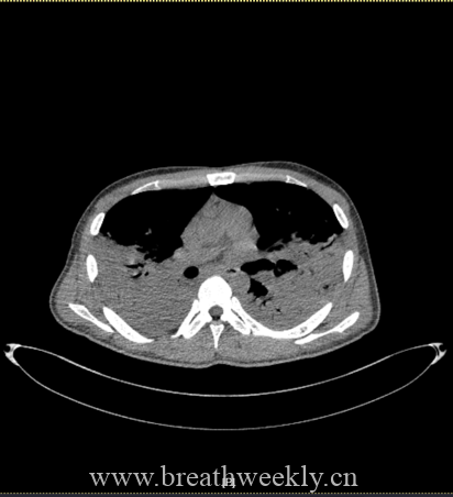 图片[37]-病例67 | 每周呼吸-每周呼吸