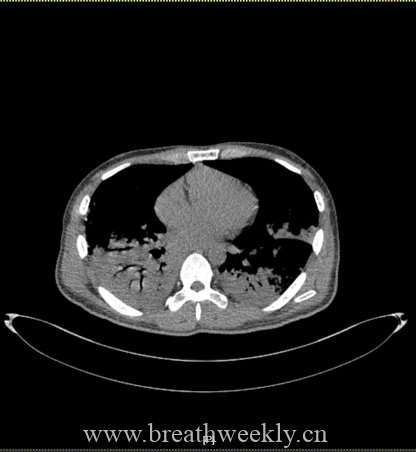 图片[40]-病例67 | 每周呼吸-每周呼吸