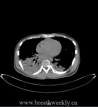 图片[41]-病例67 | 每周呼吸-每周呼吸